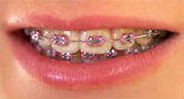 Children’s Orthodontics