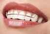 Inman aligner