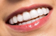 Invisalign aligners